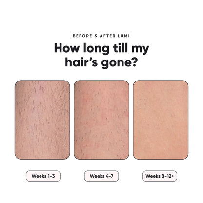 Ultimate Hair Removal Solution